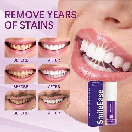 Purple Toothpaste - Image 6
